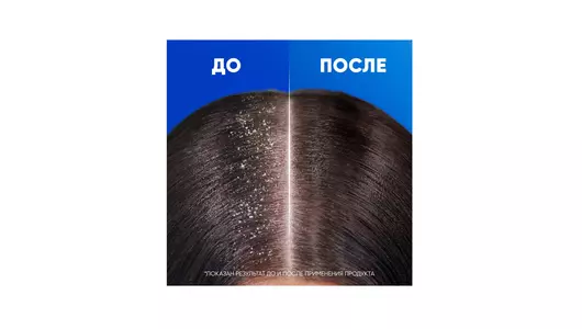 Шампунь и&nbsp;бальзам-ополаскиватель для&nbsp;волос Head&Shoulders 2в1 Основной Уход 200 мл