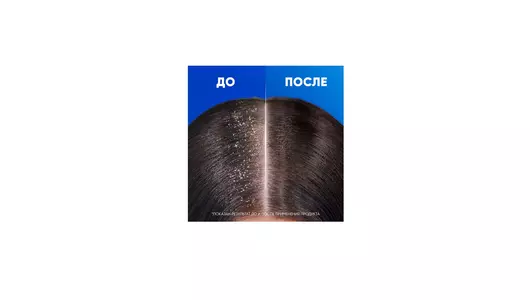 Шампунь и бальзам-ополаскиватель для волос Head&Shoulders Основной Уход 300 мл Шампунь и бальзам-ополаскиватель для волос Head&Shoulders Основной Уход 300 мл