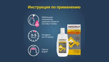 Какие шампуни от перхоти наиболее эффективны?